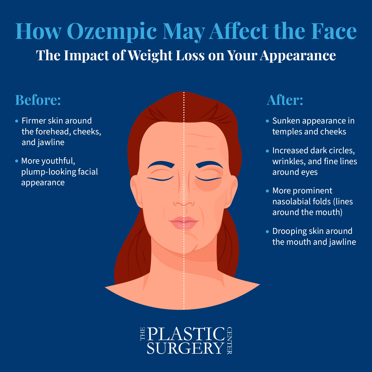 Ozempic Face Understanding and Treating Facial Drooping